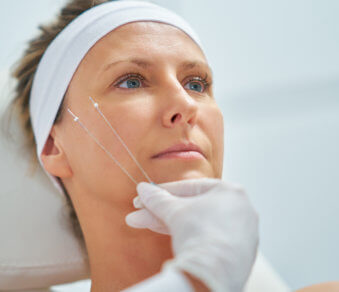 Doctor performing PDO thread insertion