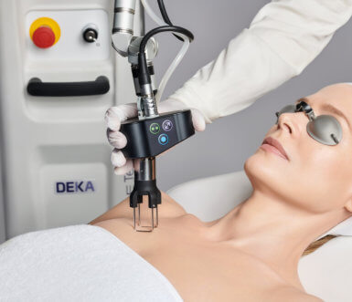 Woman receiving CoolPeel laser treatment